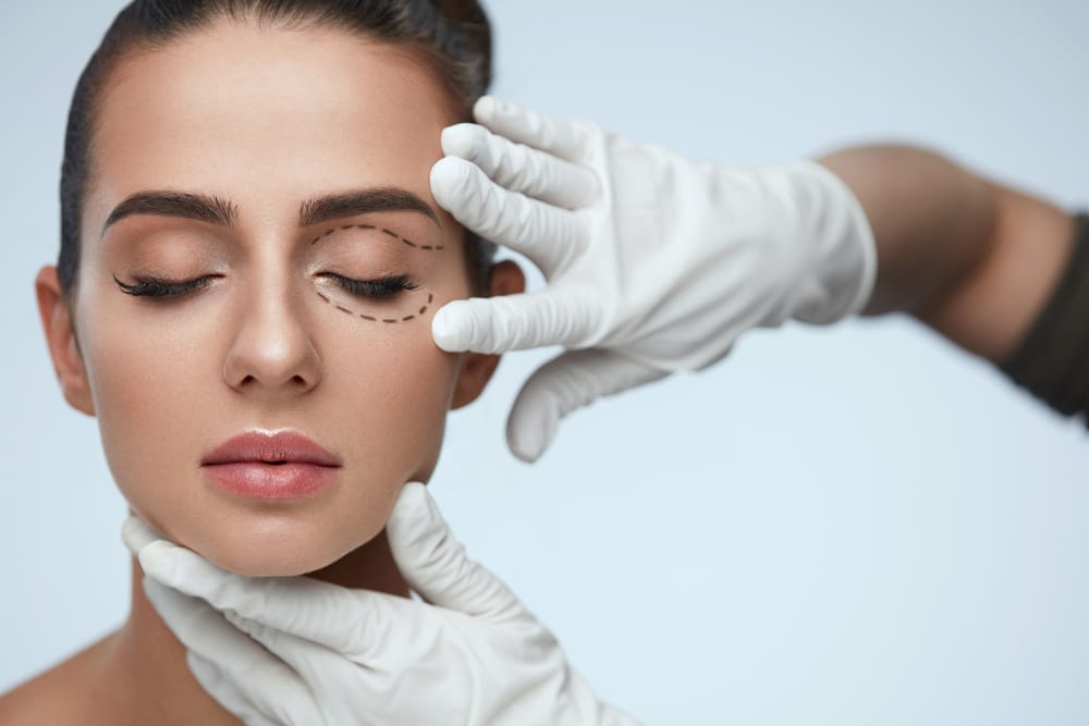 Eyelid Cosmetic Surgery (Blepharoplasty)
